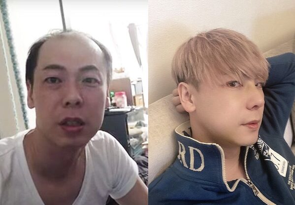 竹之内教博-かつら