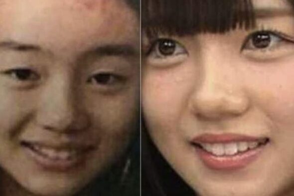 齊藤京子の顔は変わった？